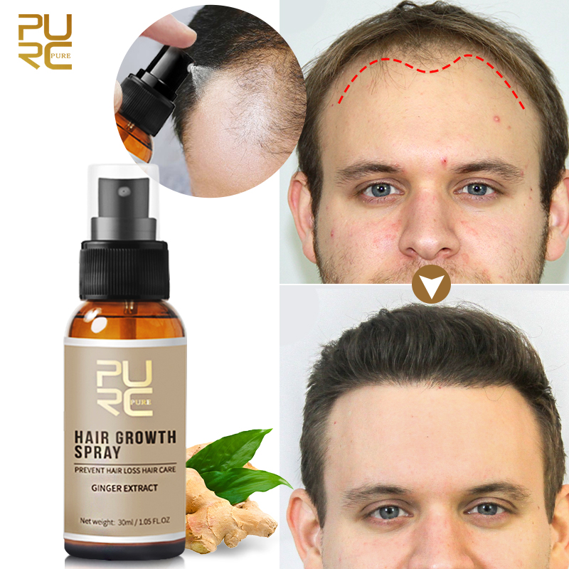 Licorice Root Sticks - PURC Ingwer-Haarwachstumsspray, Anti-Haarausfall-Produkte, nährende Kopfhaut, stärkt