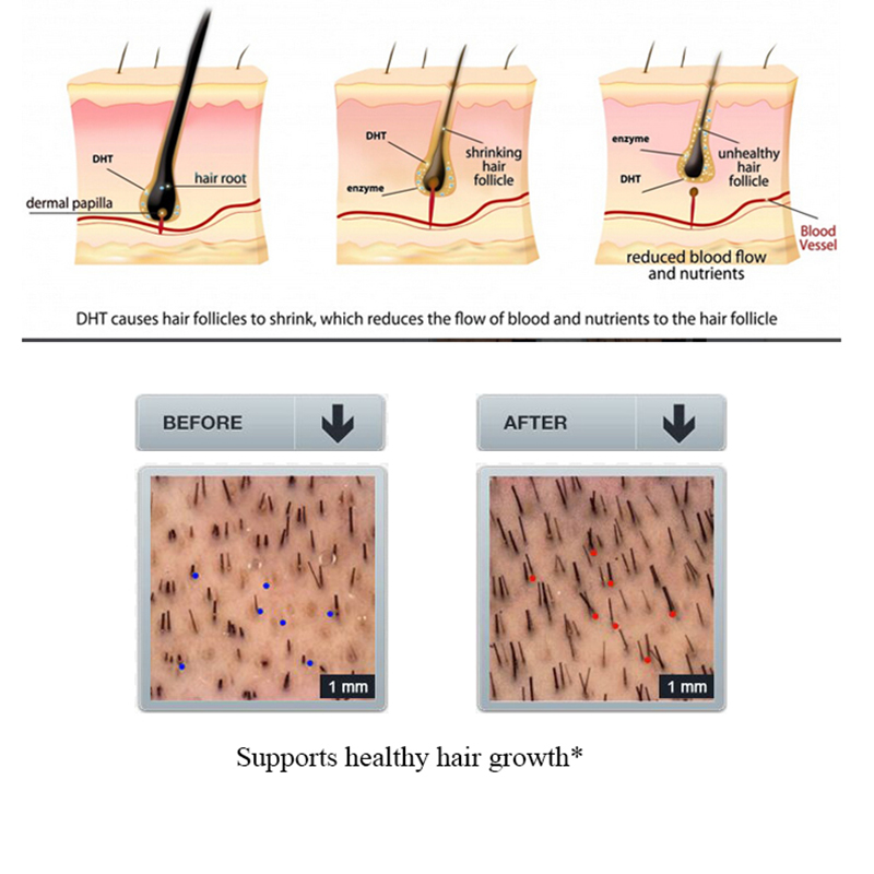 PURC Ingwer-Haarausfall-Shampo – Licorice Root Sticks Bewertung und Preis